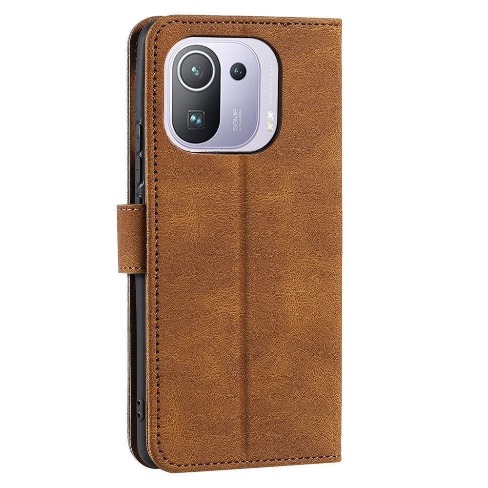 Splicing Stitching Skin-touch PU Leather Case Stand Protector Cover for Xiaomi Mi 11 Pro