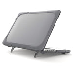 Hard PC Laptop Case Notebook Computer Cover with Supporting Stand Feet for MacBook Pro 15-inch / Pro Retina 15-inch A1398