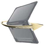 Hard PC Laptop Case Notebook Computer Cover with Supporting Stand Feet for MacBook Pro 15-inch / Pro Retina 15-inch A1398