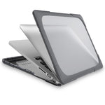 Hard PC Laptop Case Notebook Computer Cover with Supporting Stand Feet for MacBook Pro 15-inch / Pro Retina 15-inch A1398