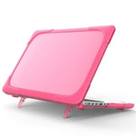 Hard PC Laptop Case Notebook Computer Cover with Supporting Stand Feet for MacBook Pro 15-inch / Pro Retina 15-inch A1398