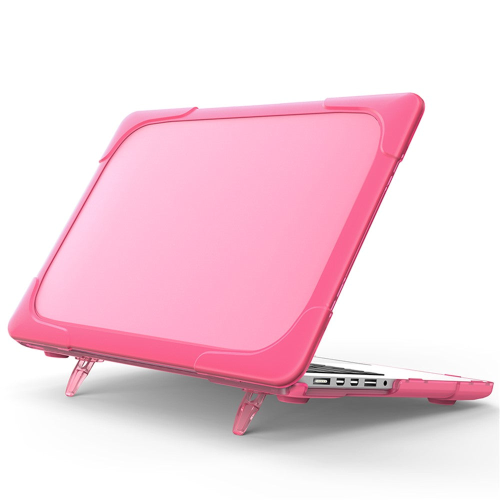Hard PC Laptop Case Notebook Computer Cover with Supporting Stand Feet for MacBook Pro 15-inch / Pro Retina 15-inch A1398