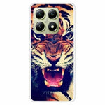 For Xiaomi 14T Case TPU Pattern Printing Anti-Fall Phone Cover