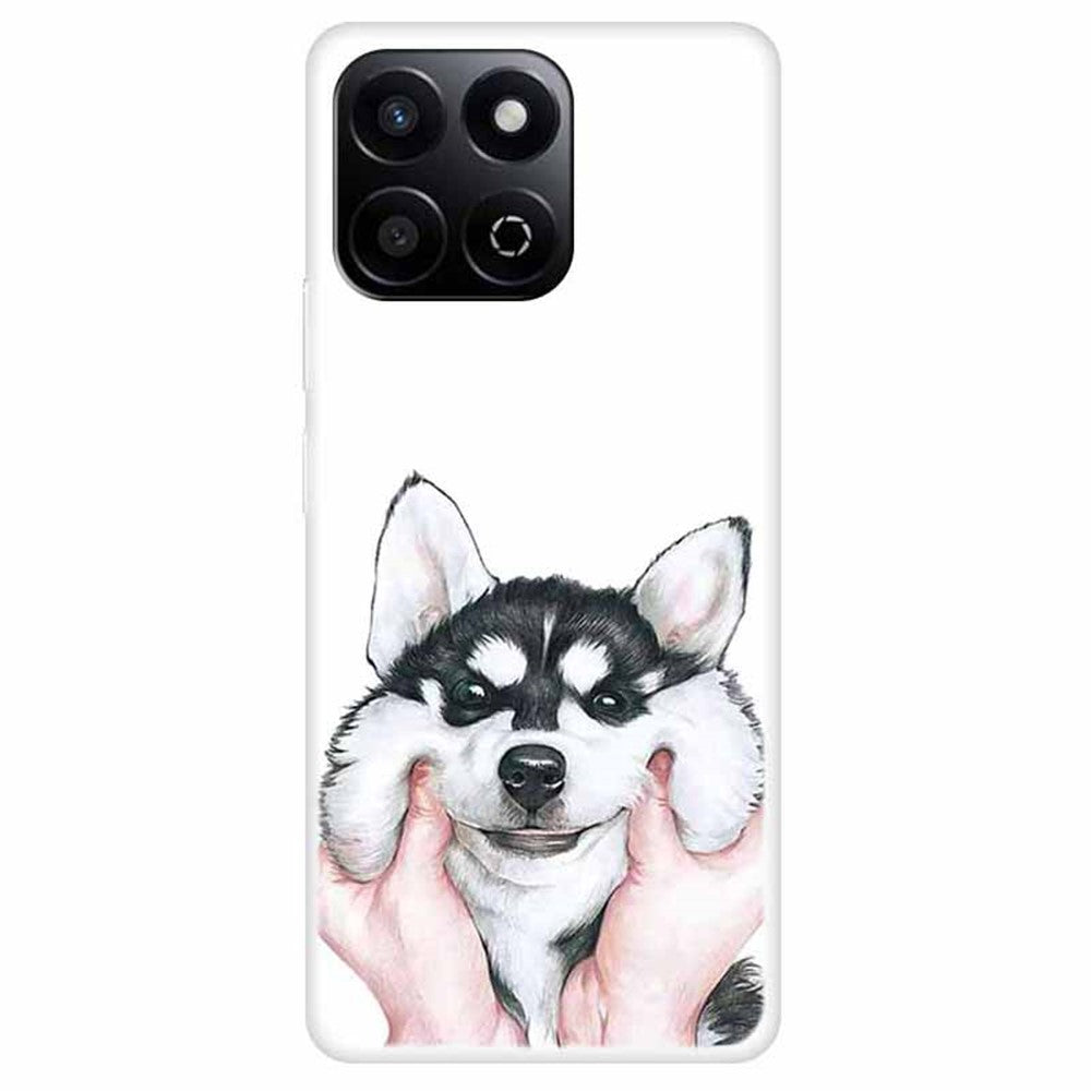 TPU Cover til Honor X7c 5G / X7c 4G / 200 Smart 5G / Play9T 5G / Play 60 Plus 5G med mønstertryk og anti-fald mobilrygcover