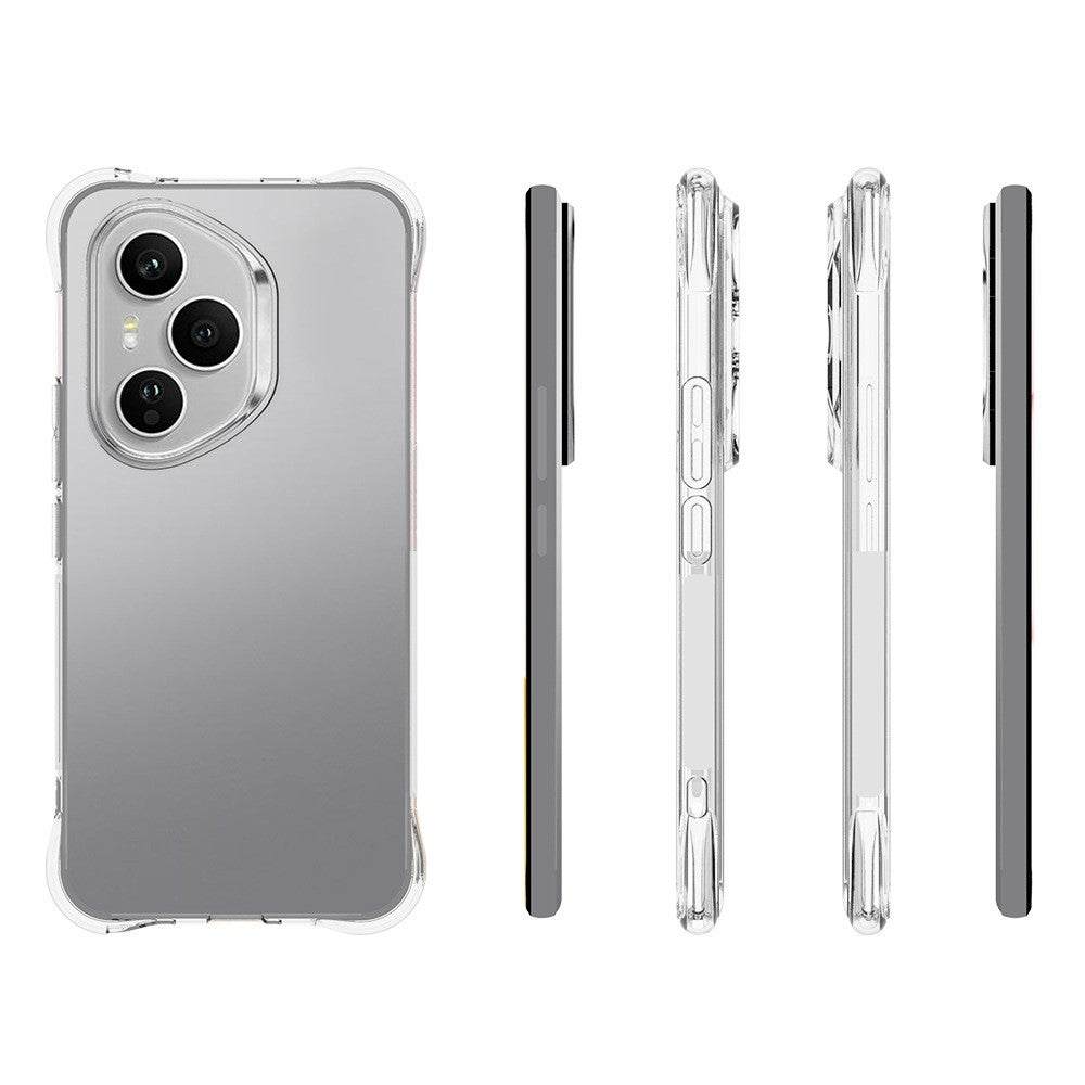 WANLONFENG For Honor 400 Pro 5G (Global) TPU Case WL2 Series 2.0mm Phone Cover with 2Pcs Tempered Glass Films
