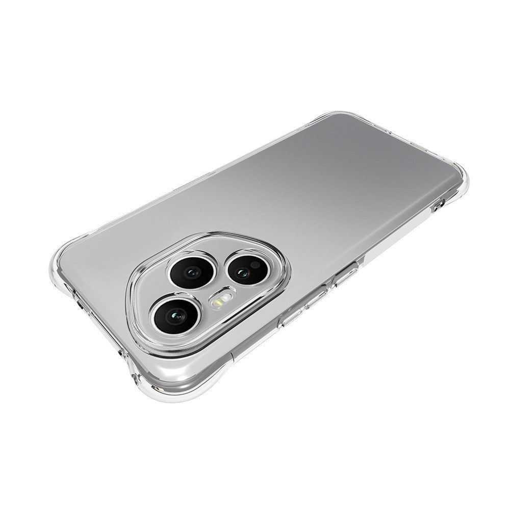 WANLONFENG For Honor 400 Pro 5G (Global) TPU Case WL2 Series 2.0mm Phone Cover with 2Pcs Tempered Glass Films