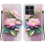 For Xiaomi 15T Case Pattern Printing Leather Flip Wallet Phone Cover with Lanyard