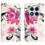 For Xiaomi Poco M8 5G / Redmi Note 15 5G (Global) Case Pattern Print PU Leather Wallet Phone Cover