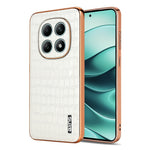 AZNS For Xiaomi Poco M8 5G / Redmi Note 15 5G (Global) Case Electroplating Crocodile Texture PU + TPU Phone Cover