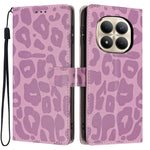 For Xiaomi Redmi Note 15 Pro+ 5G (Global)  /  Poco M8 Pro 5G Case Leopard Print Wallet Stand Flip Leather Phone Cover with Wrist Strap